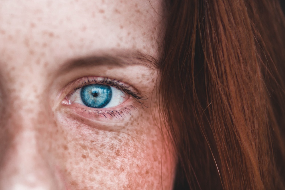 primo piano con ragazza con capelli rossi naturali occhi azzurri e lentiggini